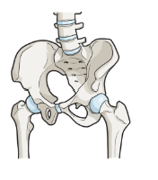 고관절 통증 증상