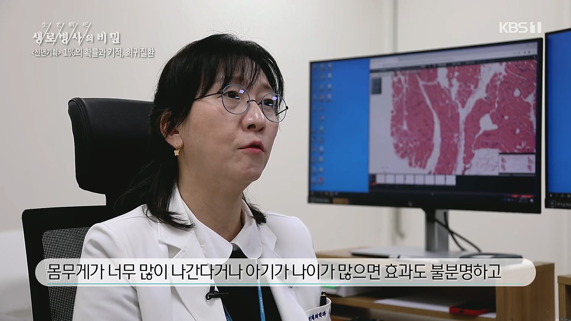 생로병사의 비밀.E850.230104p.H264-F1RST.mp4_20230117_195205.216.jpg