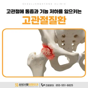 고관절 통증 증상 확인하기_9