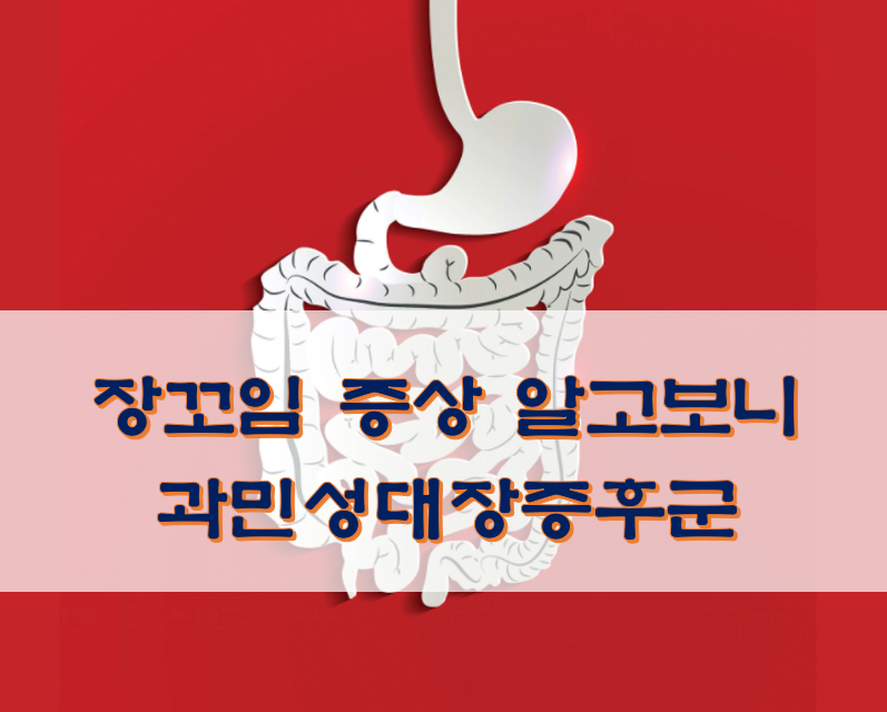  장꼬임 증상 알고보니 과민성대장증후군