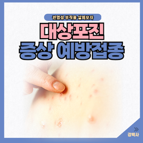 대상포진 증상 예방접종 부작용