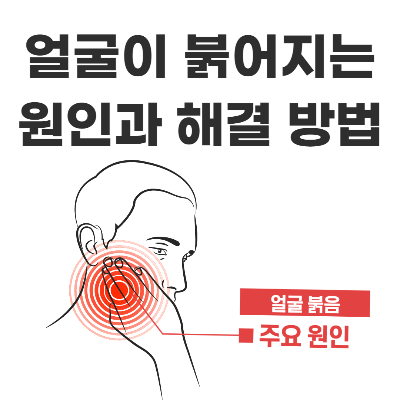 얼굴이 붉어지는 일시적인 현상과 만성적인 원인에 대한 해결 방법