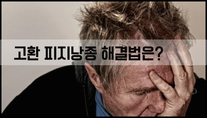 고환 피지낭종 해결법