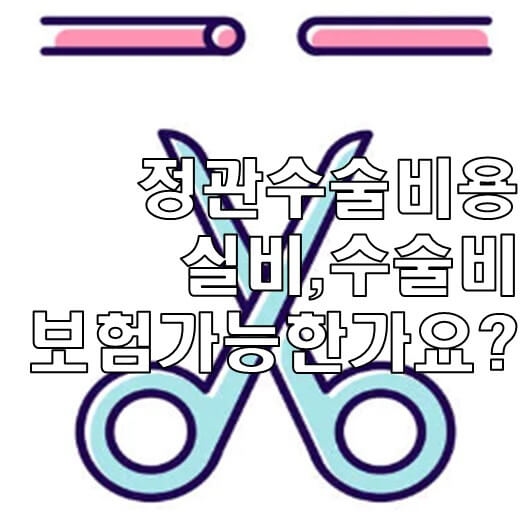 Yishan 정관 절제술 보험이 적용됩니까? 2