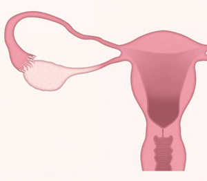 자궁과-난소-나팔관
