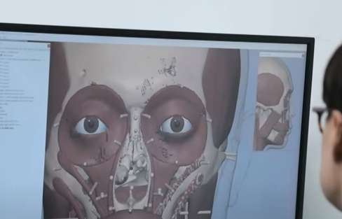 바비오 메디컬 일러스트 얼굴복원