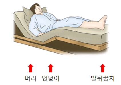  욕창 치료방법/단계/예방법