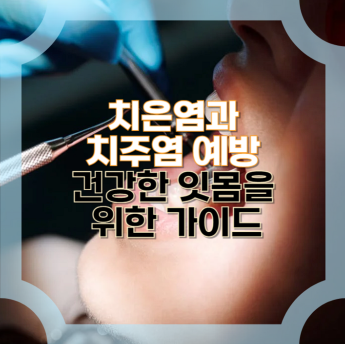 치은염 예방-치주염 증상-올바른 칫솔질 방법-잇몸 건강-구강 건강 관리-치과 정기검진-입냄새