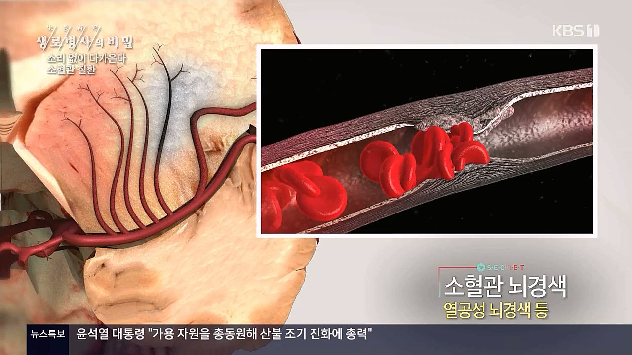 생로병사의비밀.E862.230309p.WANNA.mp4_20230309_194545.202.jpg