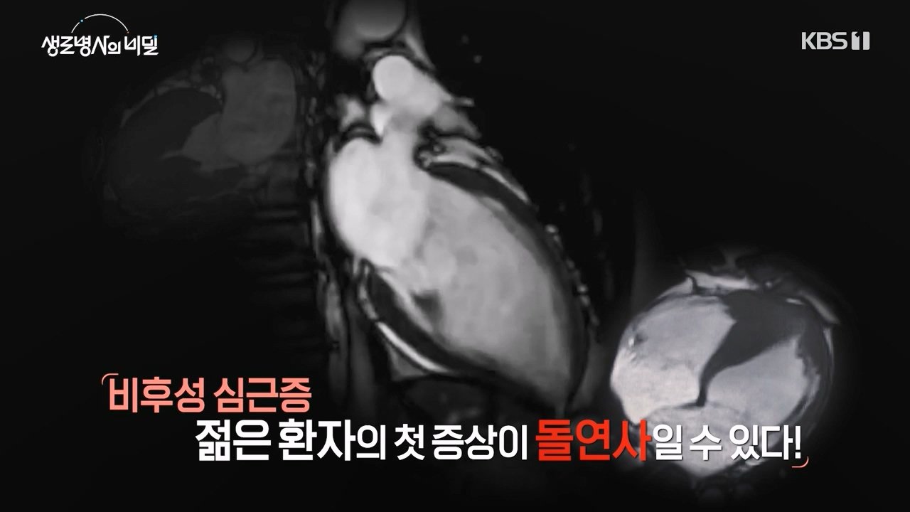 생로병사의 비밀.E912.240523p-NEXT.mp4_20240523_201950.059.jpg