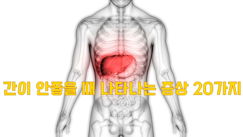  간이 안좋을 때 나타나는 증상 20가지