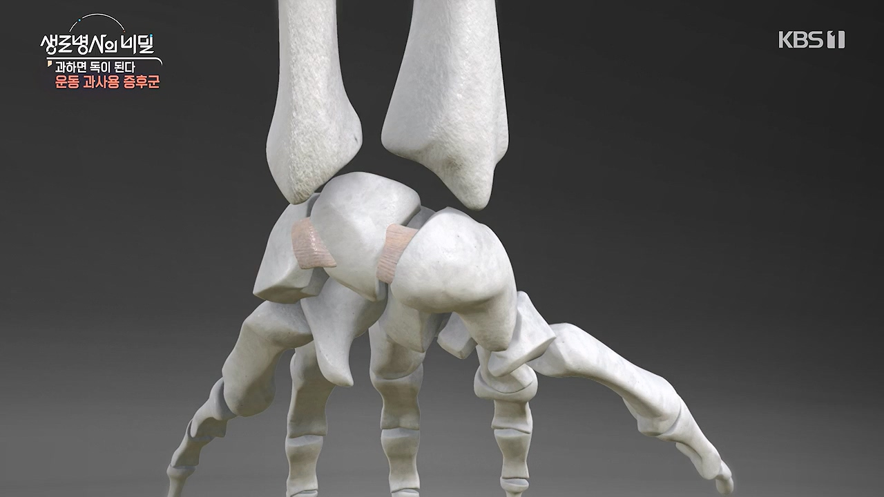 생로병사의 비밀.E918.240704p-NEXT.mp4_20240704_201615.636.jpg