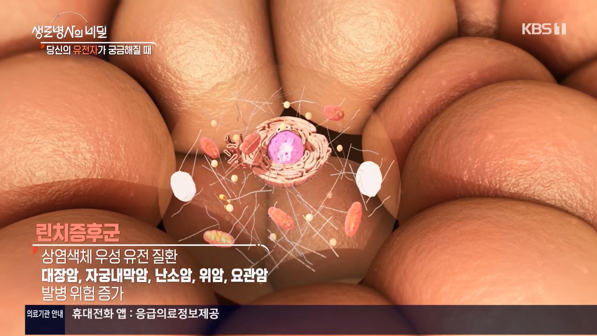 생로병사의 비밀.E905.240417p.H264-F1RST.mp4_20240418_203508.171.jpg