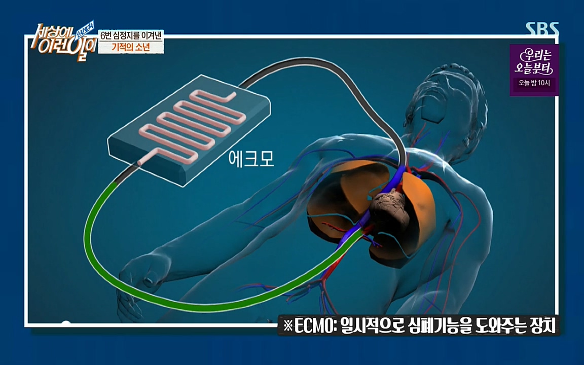 순간포착 세상에 이런일이.E1179.220511p-NEXT.mp4_20220511_174137.910.jpg