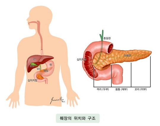 췌장암 원인&#44;증상&#44;치료&#44;수술&#44;약물