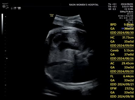 라온산부인과 초음파