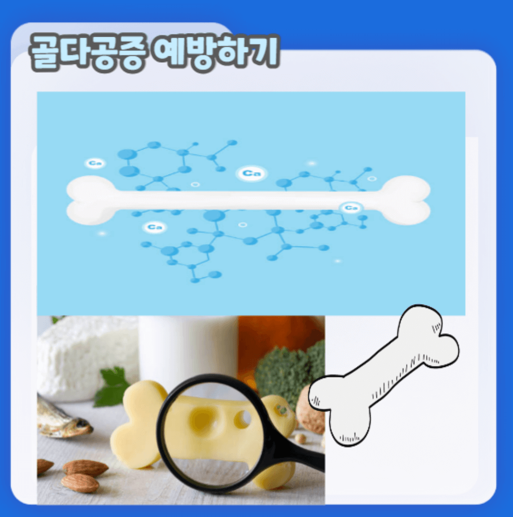 골다공증 검사비용 골밀도 검사 무상지원