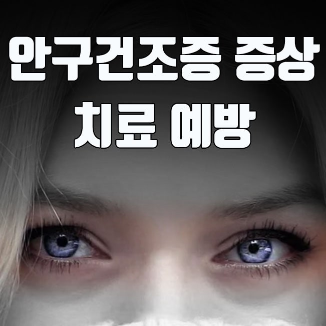  안구건조증 증상 및 치료 예방 방법