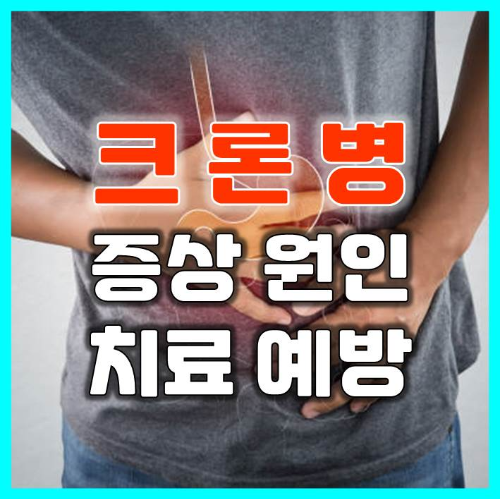  크론병 증상 치료 완치 예방 기본정보 알아보기