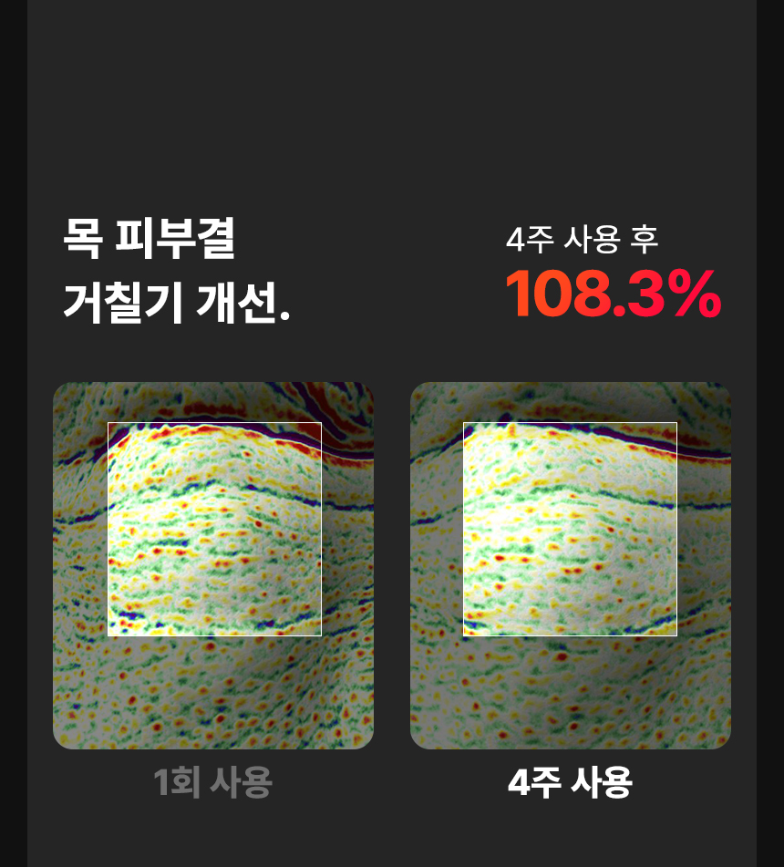 임상4주_거칠기1