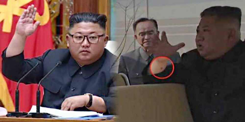  "닮은 사람이 대역하고 있을 뿐..."  정은김 사망설이 빼박이라는 증거들 ㄷㄷ (비교)
