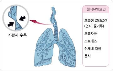 천식 증상