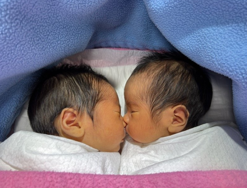 이중 쌍둥이