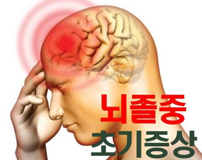어떤 사람이 뇌졸중에 걸리나요?