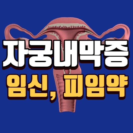  자궁내막증 임신 피임약, 검사 방법, 치료 쉽고 자세히 알아보기
