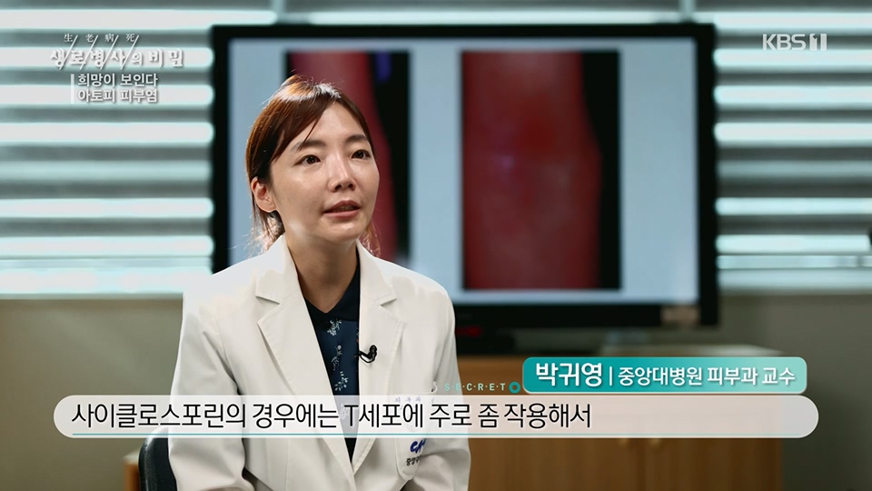 생로병사의 비밀.E872.230628p.H264-F1RST.mp4_20230707_214228.550.jpg