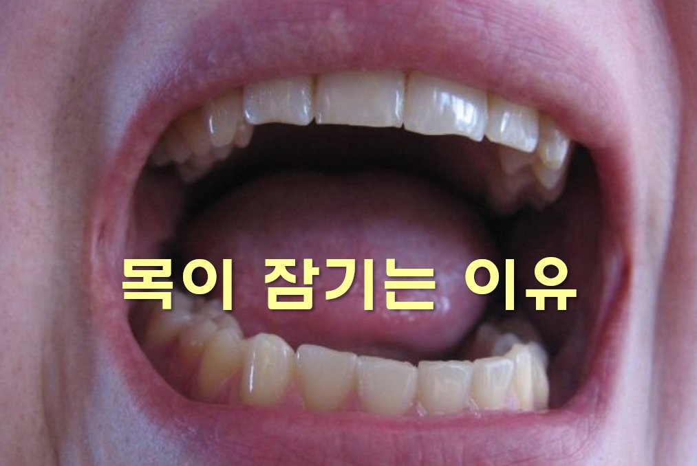  목이 잠기는 이유와 목이 쉬는 원인