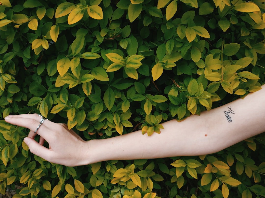 Arm