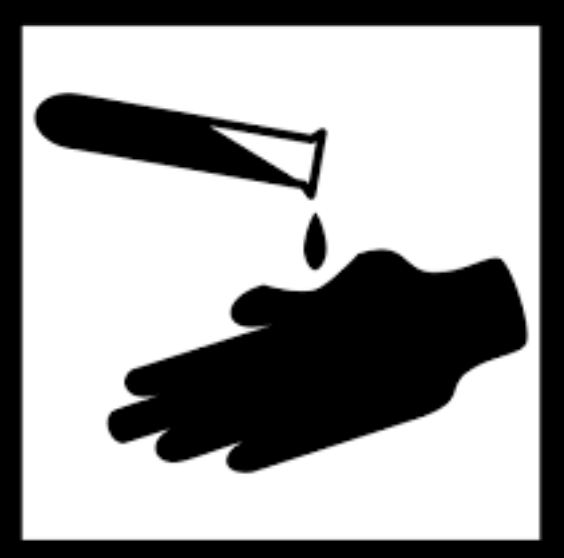 화상을 입은 경우