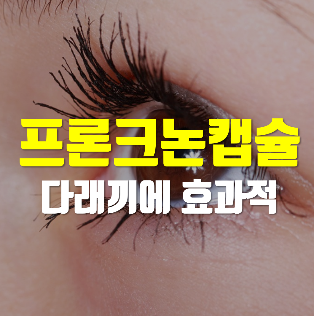  프론크논캡슐 다래끼에 효과적이네요!
