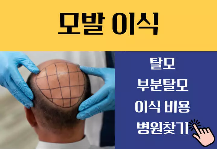 모발이식 비용~