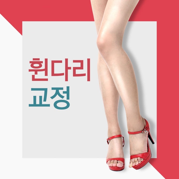  휜다리 교정