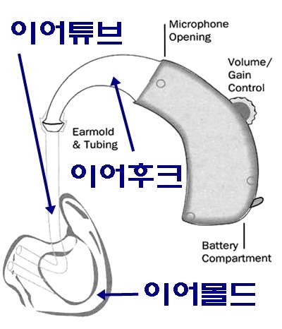  보청기 환기구(벤트) 직경이 실이음향에 미치는 영향