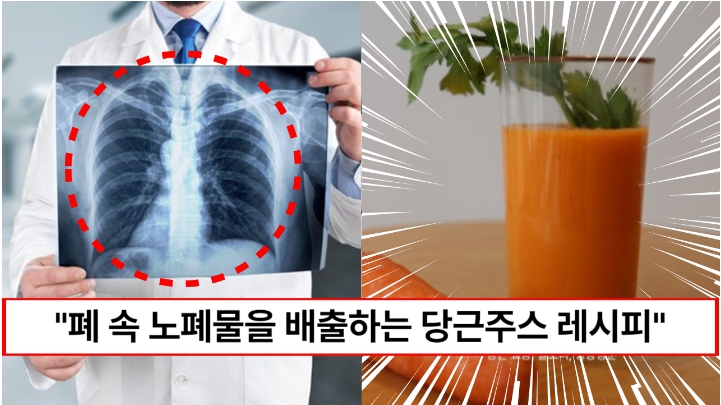 “폐 속 노폐물을 배출하고 암세포가 줄어듭니다” 폐 속 노폐물을 배출하는 당근의 베타카로틴 흡수율 높이는 비법 2가지