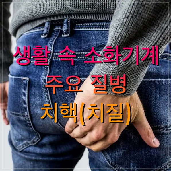 치핵 (치질) 증상 및 예방법