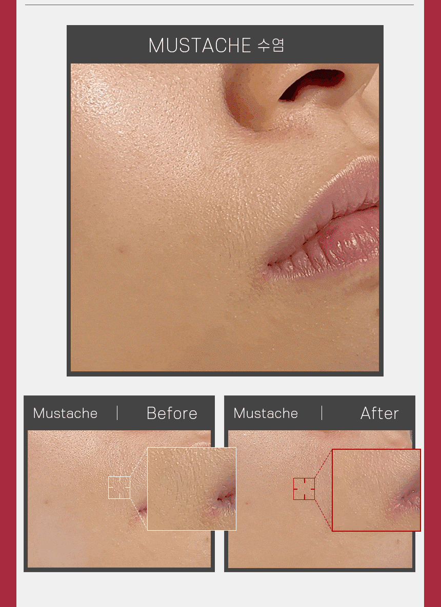 비포애프터-수염