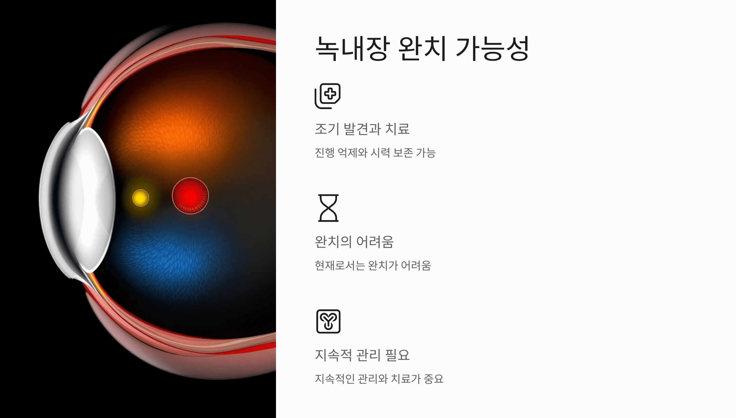 녹내장과 관련된 사진입니다.