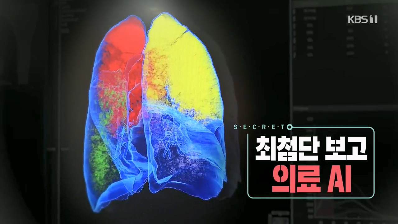 생로병사의 비밀.E869.230518p.H264-F1RST.mp4_20230518_194635.216.jpg