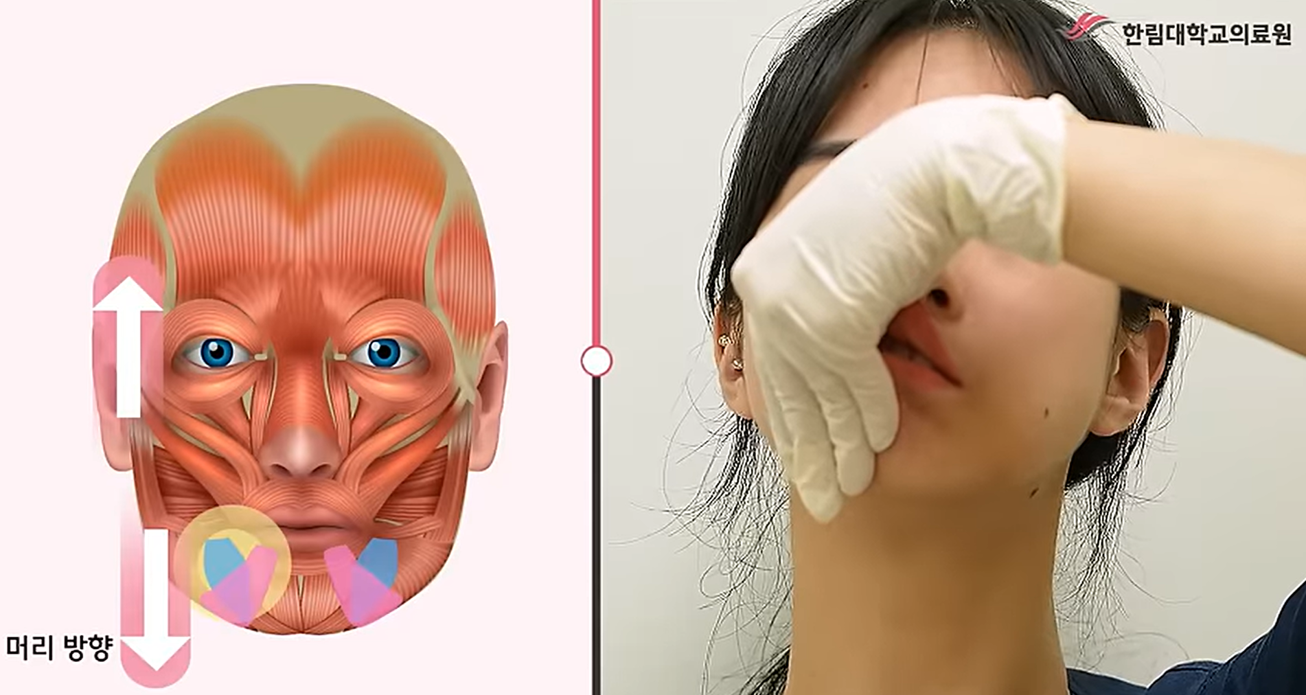 입꼬리 내림근 스트레칭
