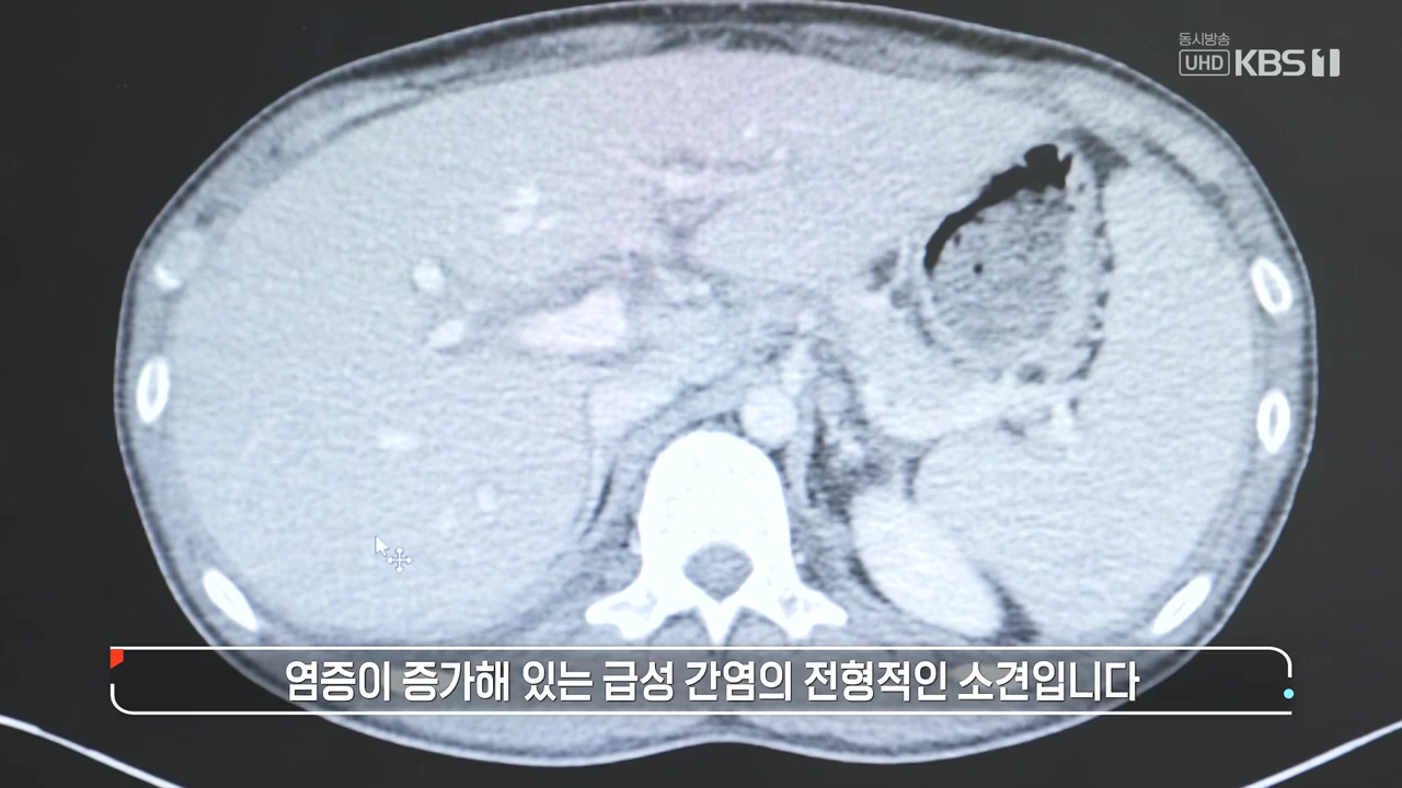 생로병사의 비밀.E910.240509p-NEXT.mp4_20240509_195909.033.jpg