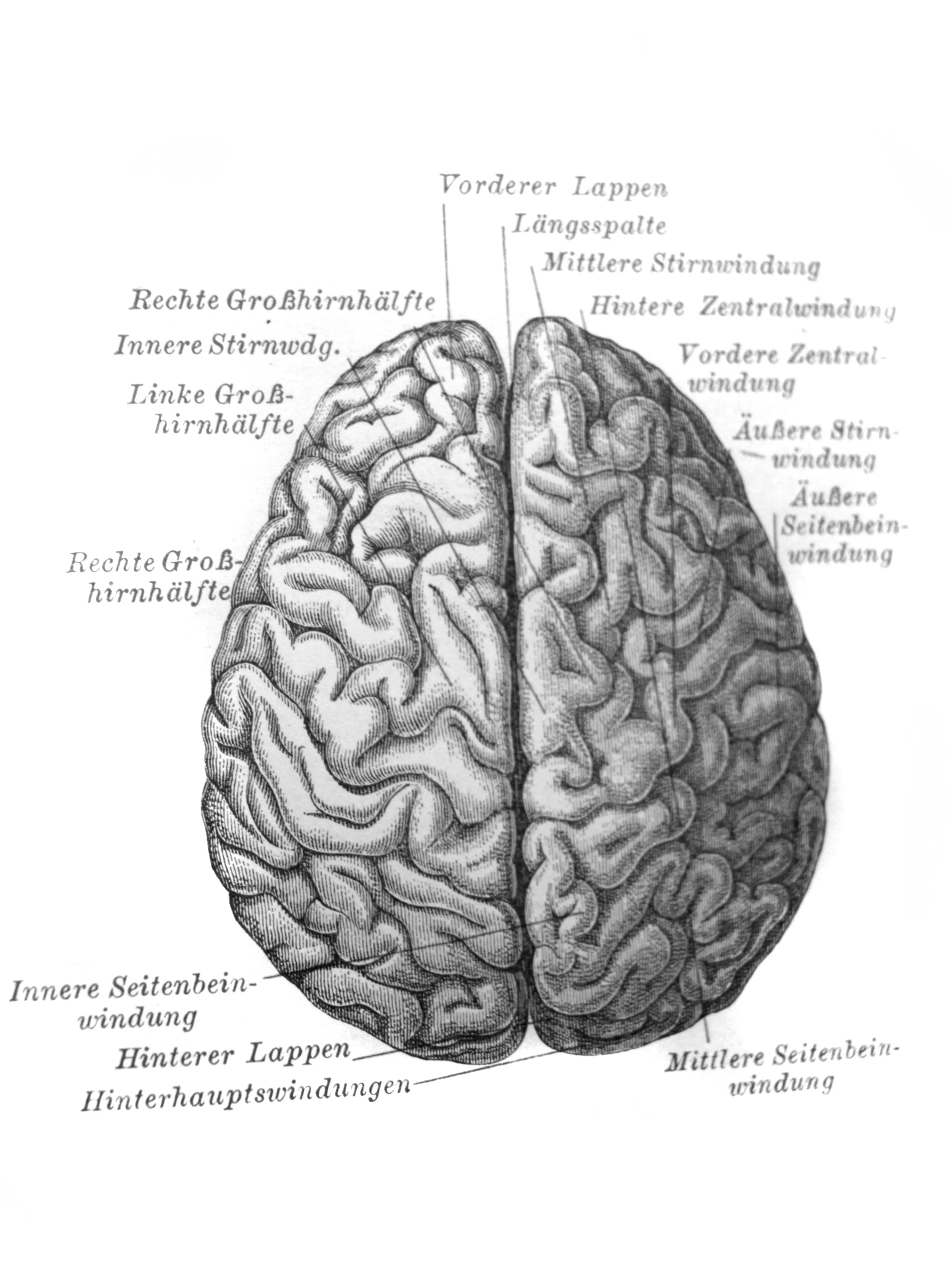 오래된 책 Meyers Lexicon&#44; vol. 1897년 7월&#44; 라이프치히 뇌
