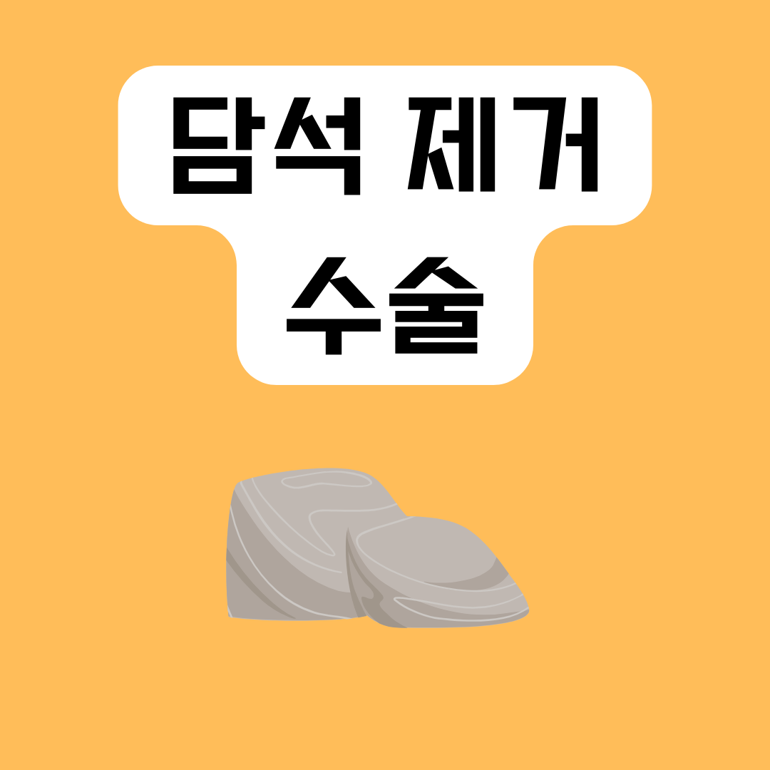 담석 수술, 언제 필요할까요?