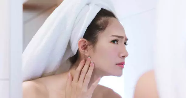 인모드 리프팅 효과 가격