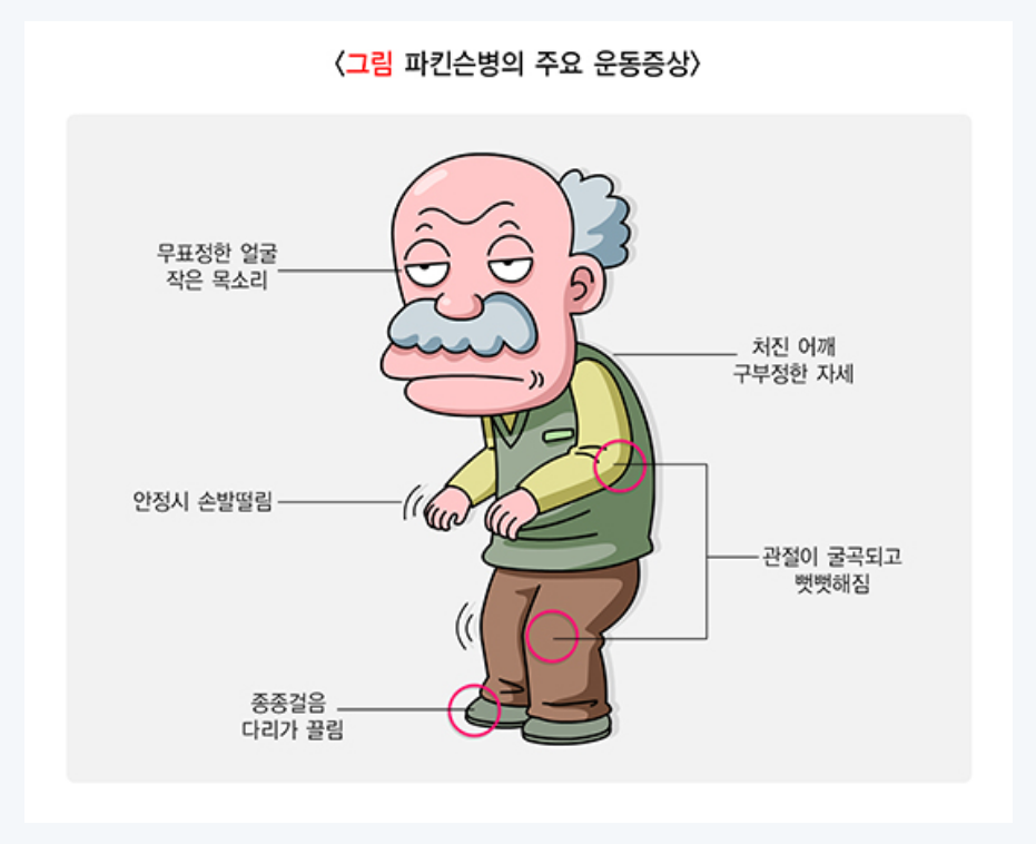 파킨슨병