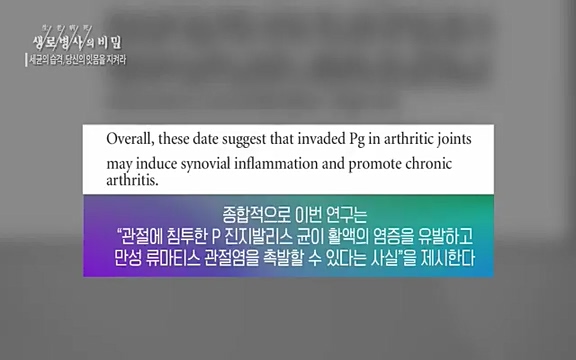 [792회] 생로병사의 비밀 - KBS[세균의 습격, 당신의 잇몸을 지켜라!] 감기보다 병원을 더 자주 찾게 만드는 질병이 있다. 바로 치주질환이다. 2020년 외래 다빈도 질병 1위를 차지한 치은염 및 치주질환 환자는 1,637_20220505_140826.653.jpg