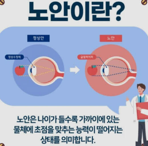  노안의 원인, 증상, 치료와 개선 방법 그리고 영양소